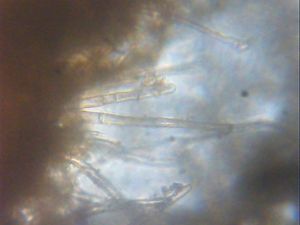 Žlutokosmatka plavá - Tricharina gilva (Boud. ex Cooke) Eckblad