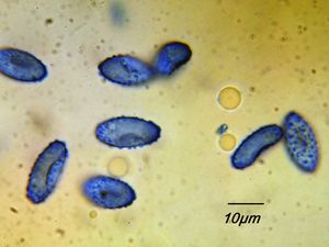 Řasnatka olivově hnědá - Phylloscypha phyllogena (Cooke) Van Vooren 2020