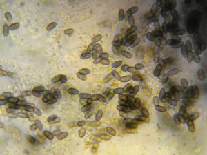 Bolinka mnohovýtrusá - Camarops polysperma (Mont.) E. Müll.