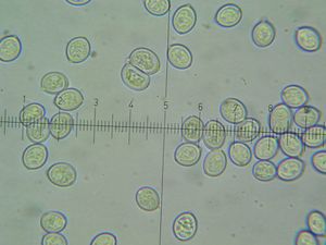 Bedla vysoká - Macrolepiota procera (Scop.) Singer 1948