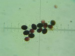 Bedla vysoká - Macrolepiota procera (Scop.) Singer 1948